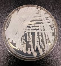 Candida auris, une nouvelle menace?