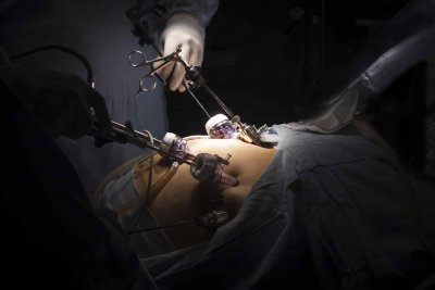 Avis  SF2S/SF2H relatif aux dispositifs médicaux réutilisables devant être stériles