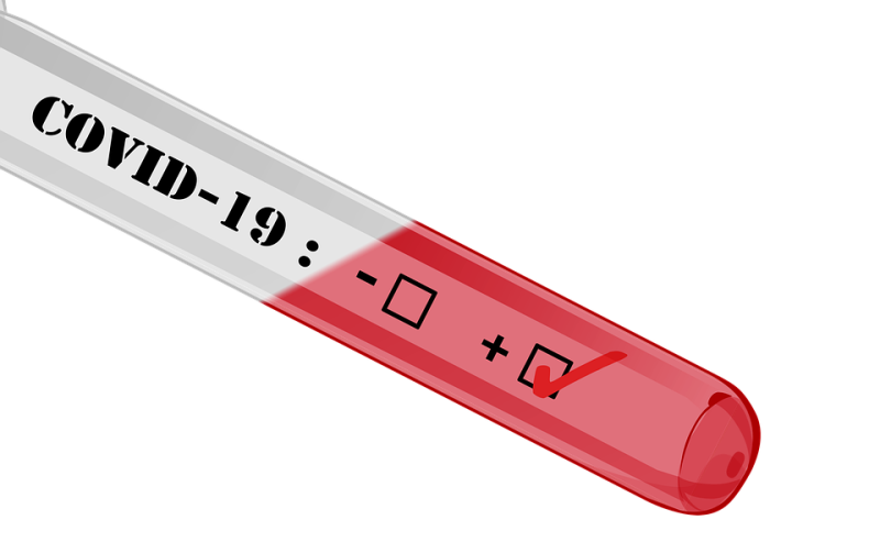 Mise au point du CNR sur la réalisation des prélèvements et la sensibilité des tests RT-PCR pour la détection du SARS-CoV-2